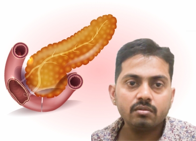 acute pancreatitis 