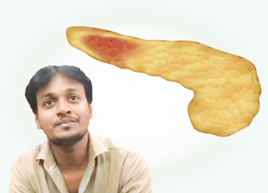 pancreatitis signs