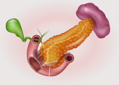 acute pancreatitis